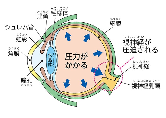 眼圧とは